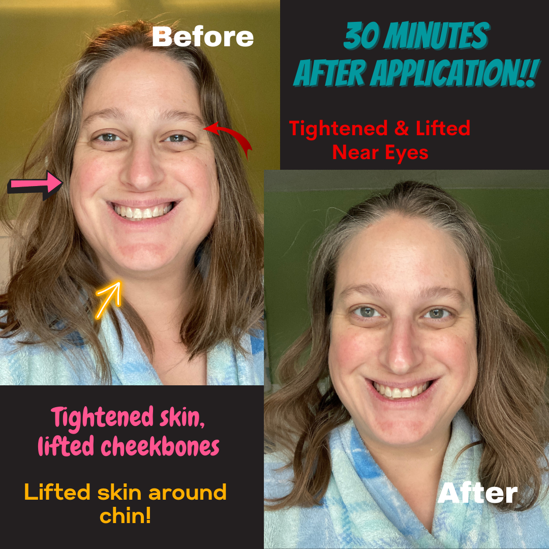 Face Lift with Activator